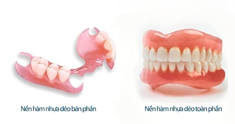 Trồng Răng Giả Hàm Tháo Lắp: Giải Pháp Tiết Kiệm Cho Người Mất Răng