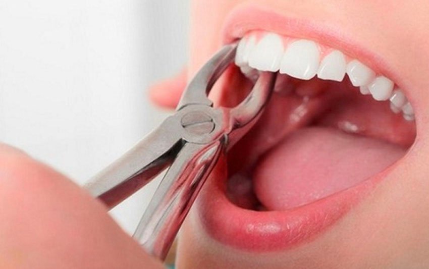 Nha khoa tổng quát