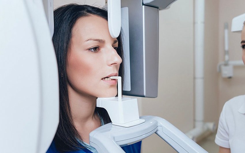 Nhổ răng khôn mọc ngầm an toàn, nhanh chóng, ít sưng đau