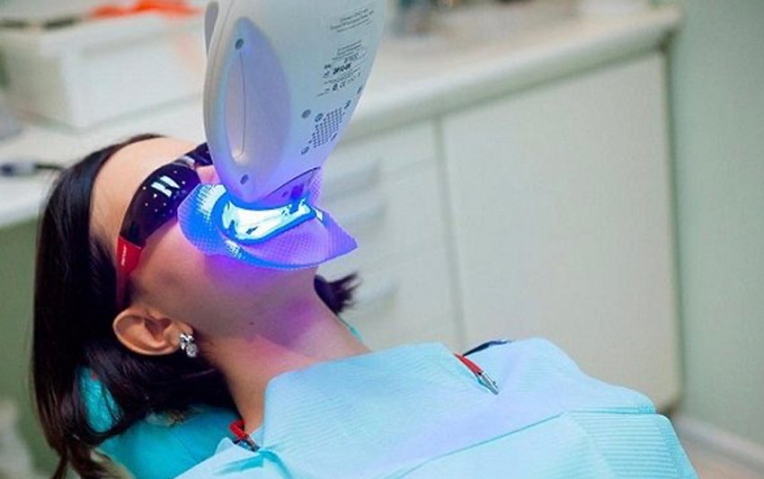 Teeth Whitening at Nha Khoa 3C: Achieve 3 Shades Lighter in Just 60 Minutes